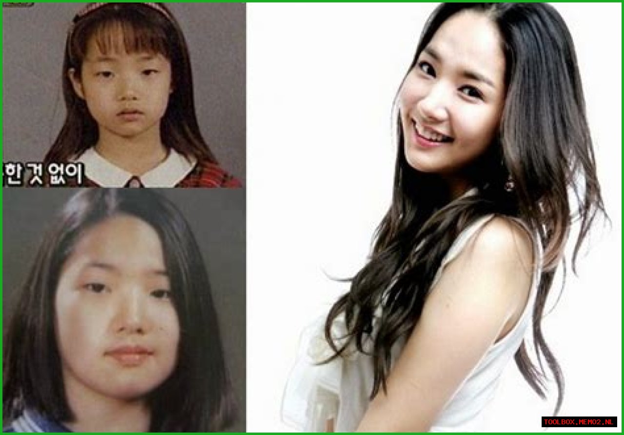 Park Min Young's Transformation: Uncovering The Journey Before Surgery